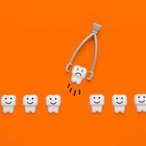 How Long Should You Wait to Exercise After Tooth Extraction