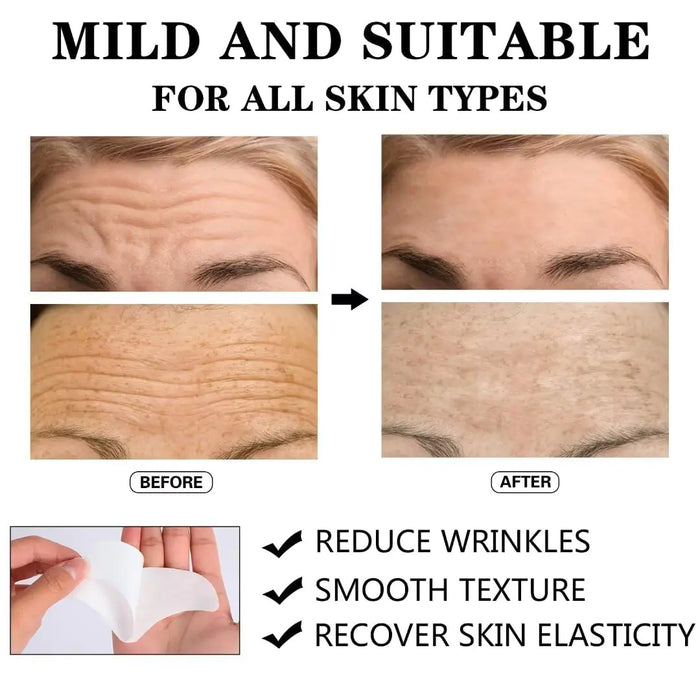 Forehead Wrinkle Patches (12pcs) - Smooth Fine Lines & Wrinkles Naturally